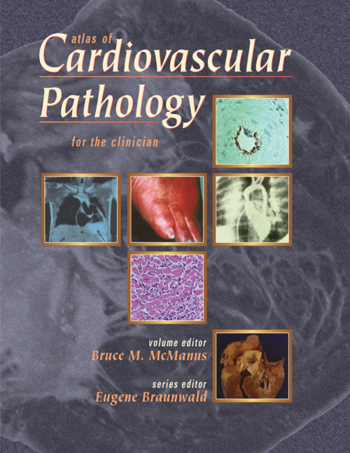 Atlas of Cardiovascular Pathology front cover 1000x1305