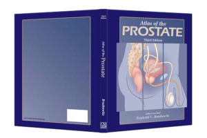 Atlas of the Prostate cover spread 1000x667