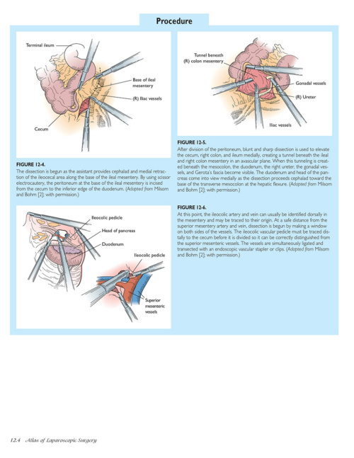 Atlas of Laparoscopic Laser Surgery p4 1000x1228