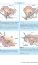 Atlas Of Laparoscopic Laser Surgery P7 1000X1228