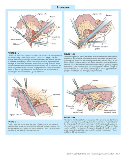 Atlas of Laparoscopic Laser Surgery p7 1000x1228