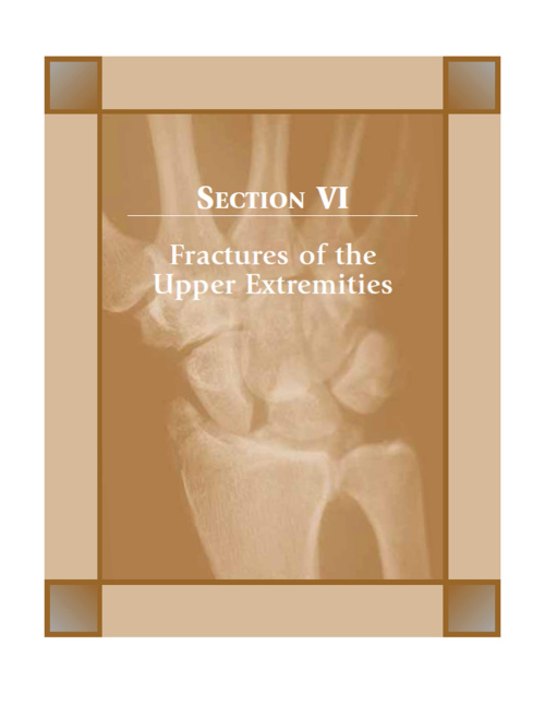 Current Diagnosis and Treatment of Fractures p2 1000x1292