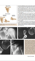 Current Diagnosis And Treatment Of Fractures P9 1000X1292