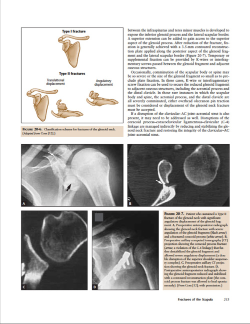 Current Diagnosis and Treatment of Fractures p9 1000x1292