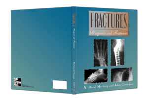 Fractures Diagnosis and Treatment cover spread 1000x667