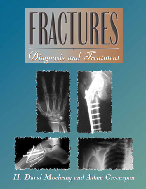 Current Diagnosis and Treatment of Fractures front cover 1000x1292