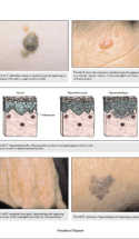 Current Practice Of Medicine Dermatology P7 1000X1293