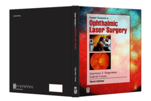 Current Techniques in Ophthalmic Laser Surgery cover spread 1000x667